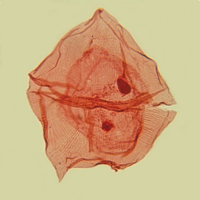 Microfossils